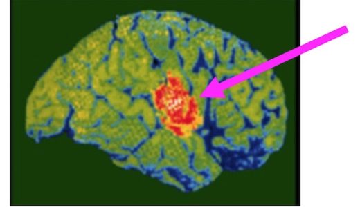 意思決定のミスを連発させる 決断疲労 とは
